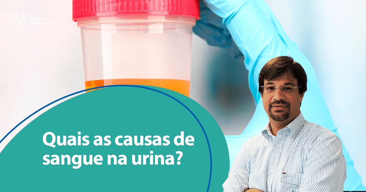 Quais as causas de sangue na urina Dr Cássio Andreoni Urologista CRM
