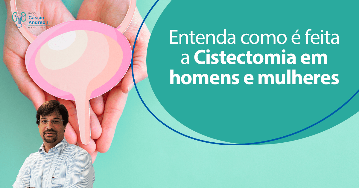 Entenda como é feita a Cistectomia em homens e mulheres Dr Cássio Andreoni Urologista CRM